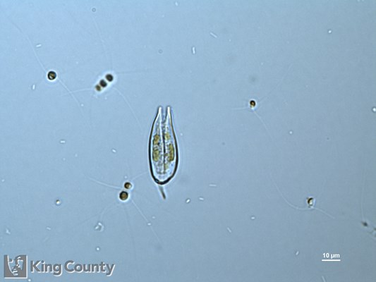 Photo of Prorocentrum gracile